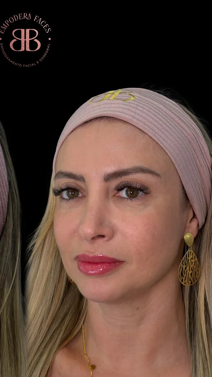 Post do Instagram da Dra. Barbara Postal com antes e depois