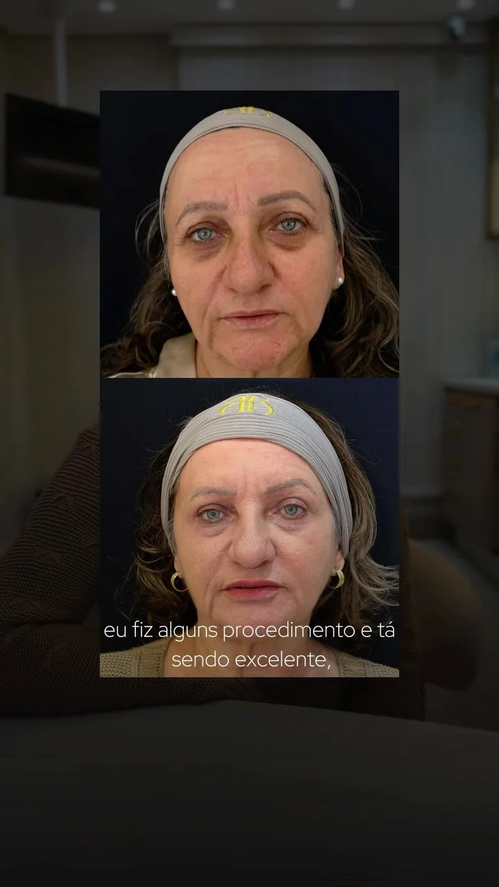 Post do Instagram da Dra. Barbara Postal com relato de paciente